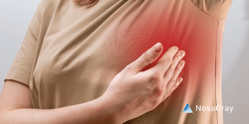 fibrose du sein post radiothérapie